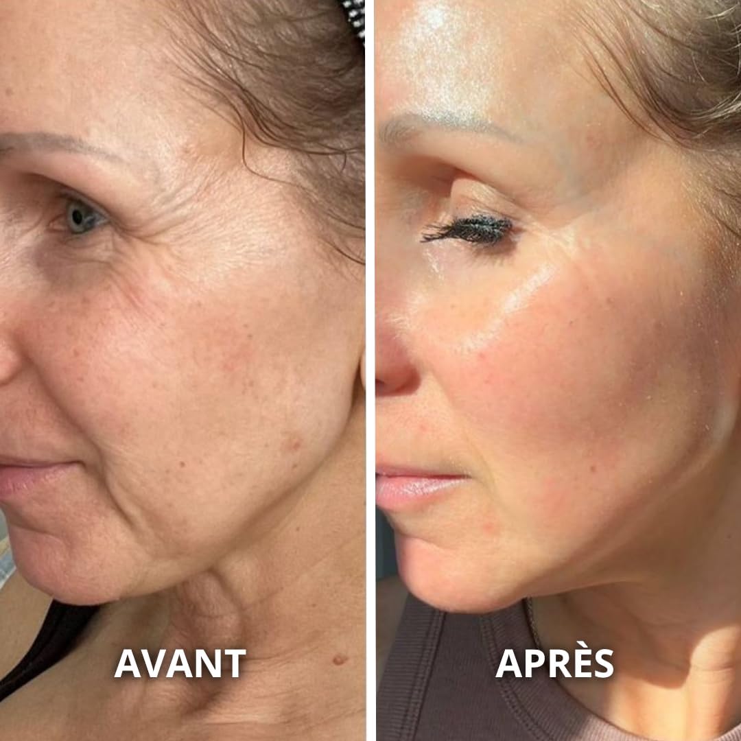 Organic Prickly Pear Seed Oil 30 ml - Pipette - Glass Bottle - 100% Pure, Natural, Cold Pressed - Organic Prickly Pear Oil for Face Anti-Aging and Anti-Dark Circles - Image 5