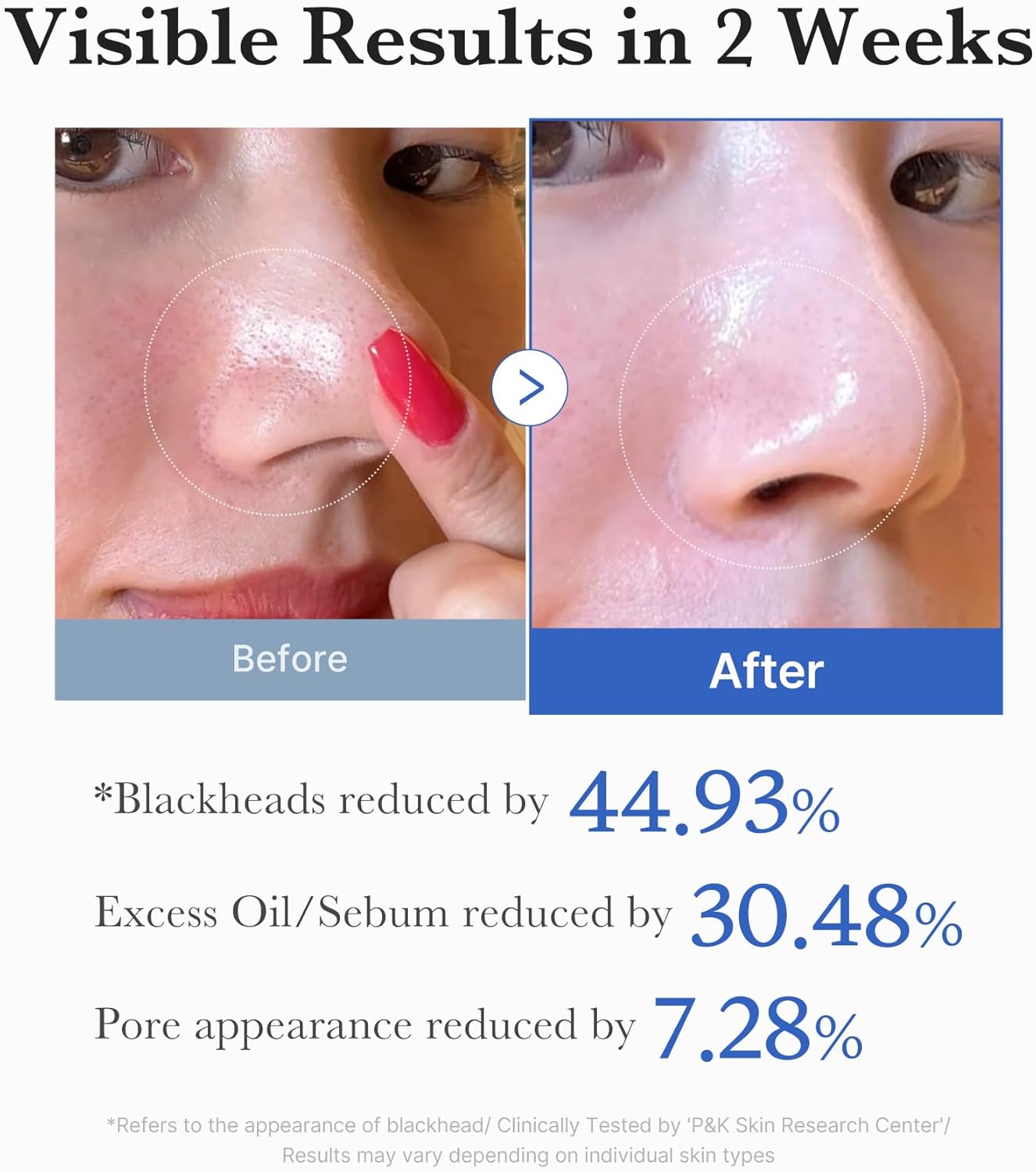 medicube Zero Pore Pads 2.0, Double Texture Facial Toners For Exfoliation And Pore Care With 4.5% Lactic Acid Aha (70 Unidades) - Image 6