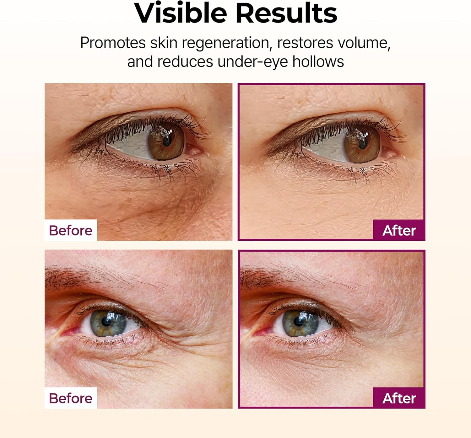 Dr.Melaxin Cemrete Multi Purpose Calcium Balm 9g - Image 5