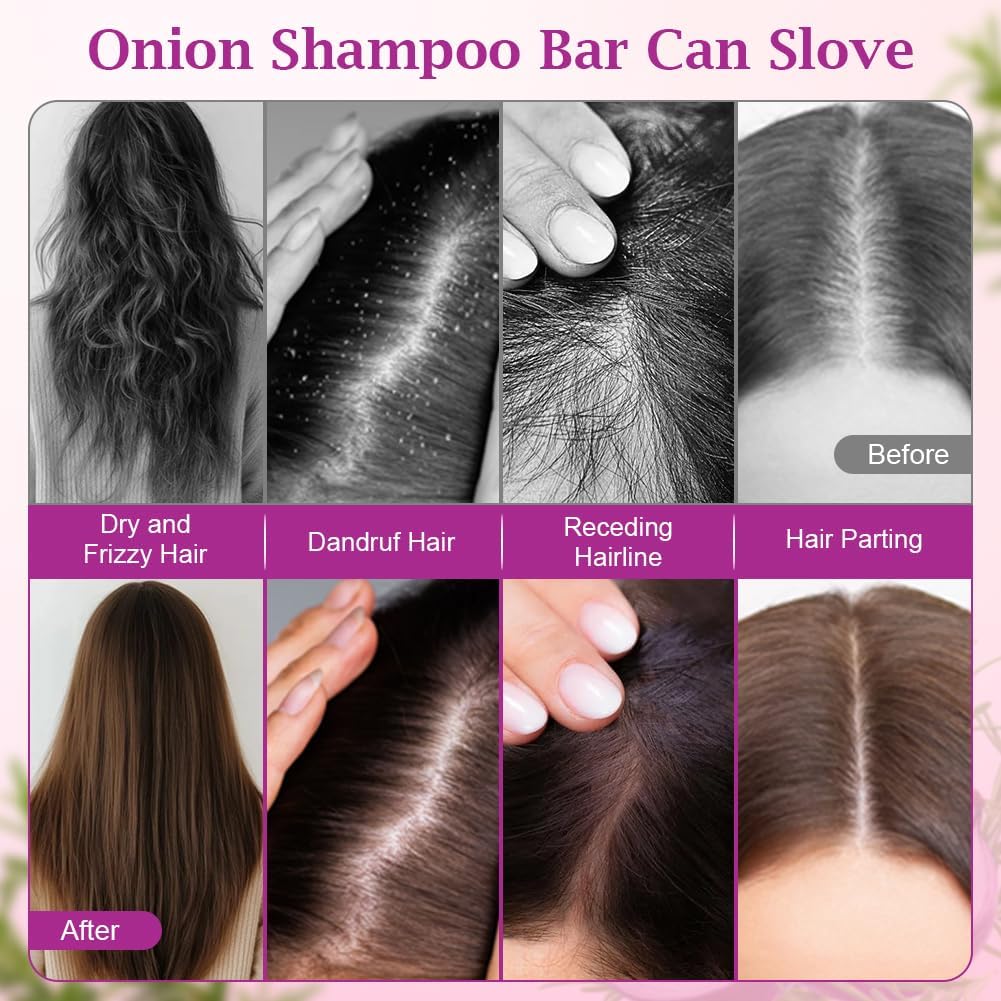LOPHE Onion Solid Shampoo, Solid Onion and Rosemary Shampoo with Biotin & Collagen, Natural Solid Shampoo for Hair and Scalp, Travel Size, 60g, 2PCS - Image 5