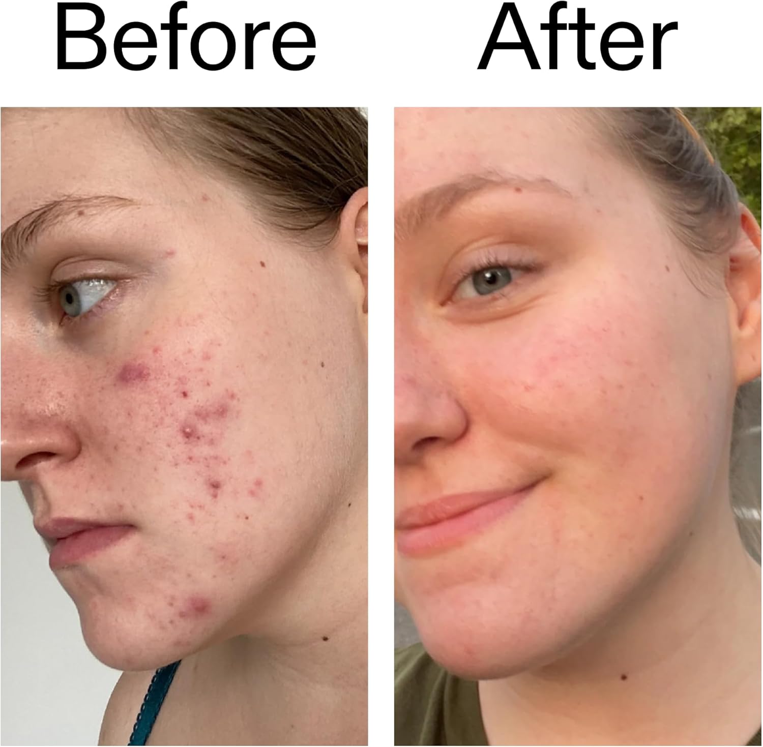 The INKEY List 15% Vitamin C and EGF Serum helps intensively lighten all skin types 30ml - Image 9