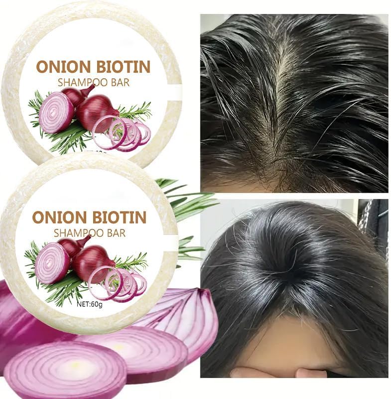 Onion Biotin Shampoo Bar, Onion Rosemary Shampoo Soap, Nourishing Purifying Onion Biotin Shampoos Soap, Moisturizing Onion Shampoo Rosemary Hair Soaps Bars - Image 7