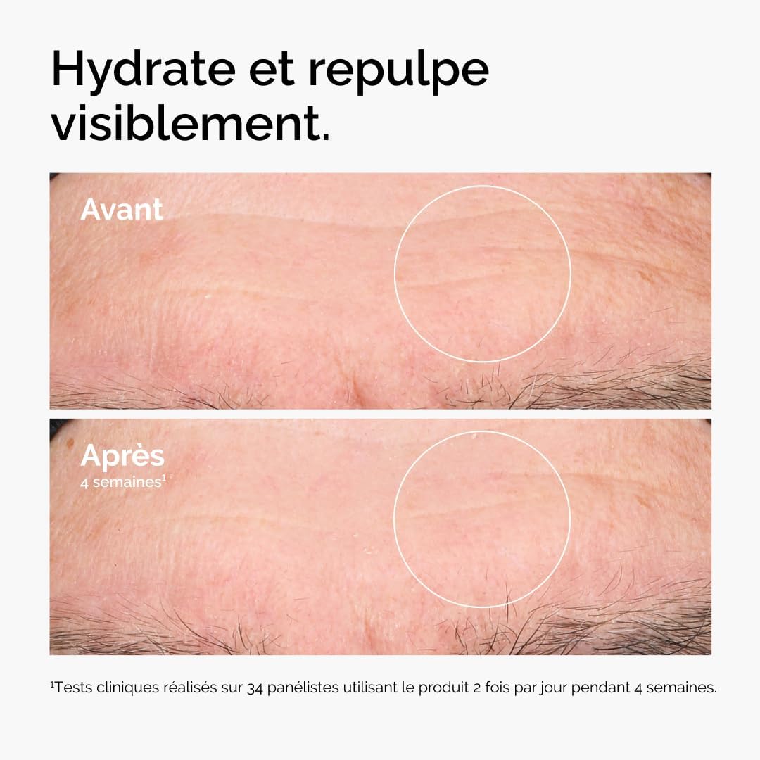 The Ordinary Hyaluronic Acid 2% + B5 (with Ceramides), Multi-Depth Hydration Serum for Plumper, Smoother Skin, 30ml - Image 3