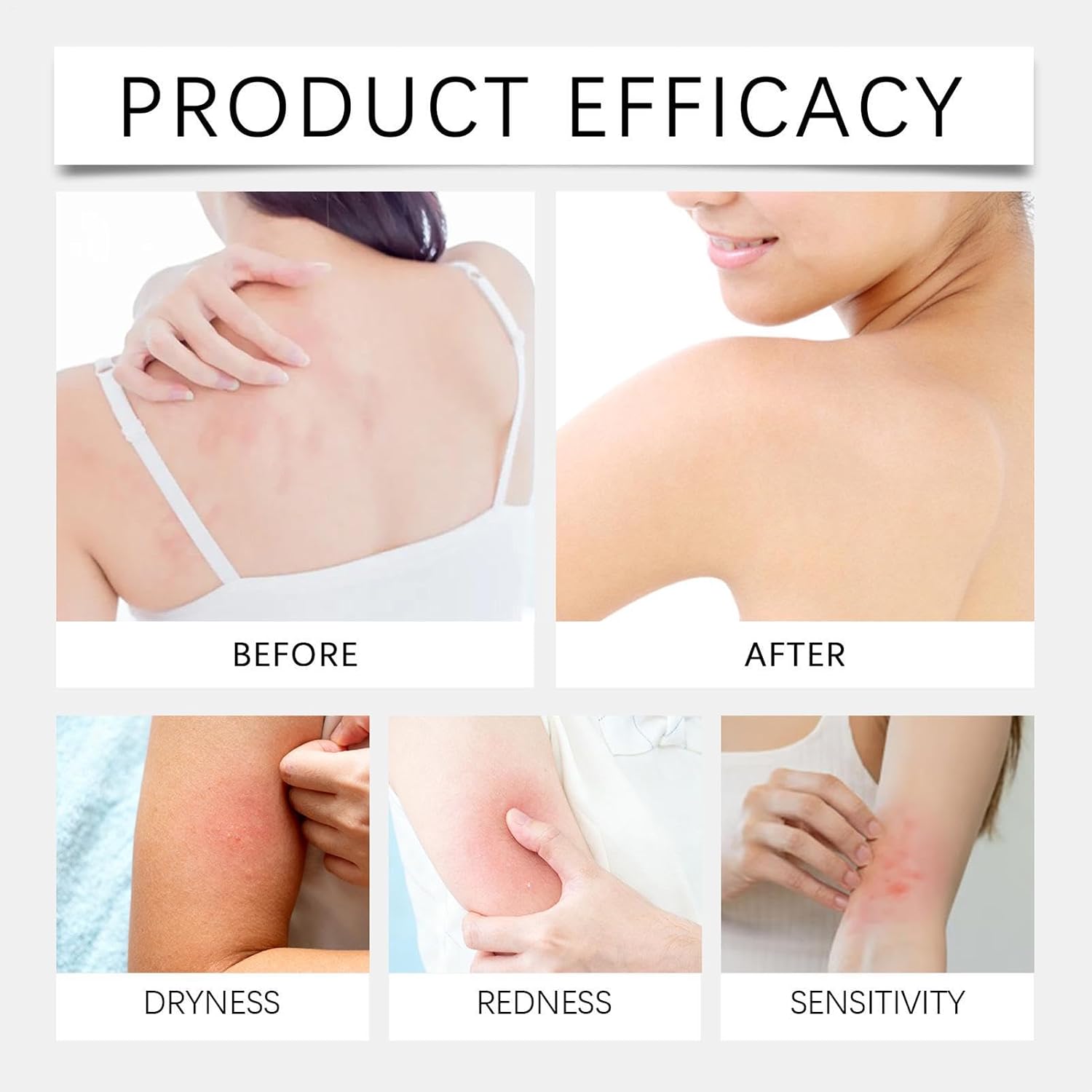 10 In 1 Biotin Skin Restoration Cream, With 7 Days Warts, Grains & Acne Removal, 50G, Skin Treatment Cream, Collagen Lift Serum, Elas - Image 6