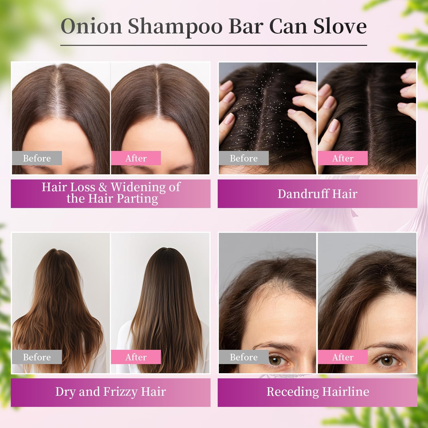 Onion Biotin Shampoo Bar for Growth, Cleans and Nourishes Scalp Smoothly, Promoting Hair Growth and All Hair Types (Green) - Image 6
