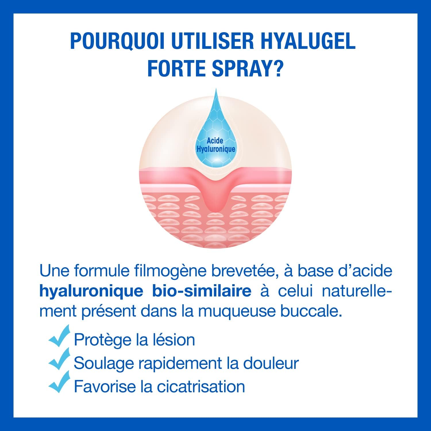 HYALUGEL Mouth Spray - Severe and Painful Wounds - Aphthae - Hyaluronic Acid - 20 ml - Image 5