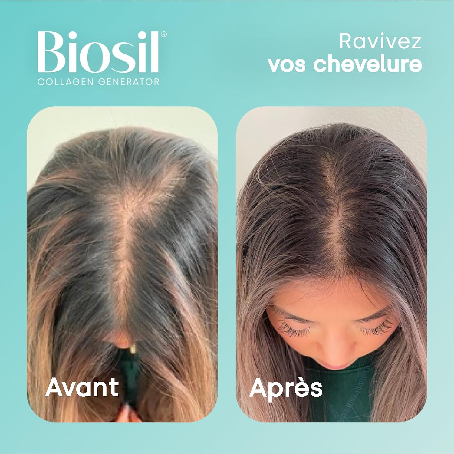 Biosil Collagen Generator - 15 mL Drops - Image 6